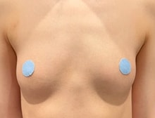 今月のベスト症例写真