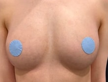 今月のベスト症例写真