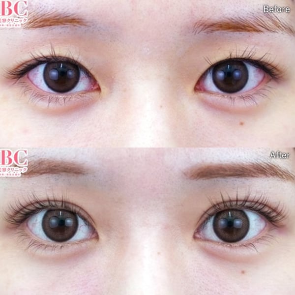 赤尾 健医師 症例写真