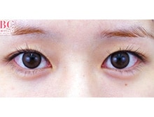 今月のベスト症例写真