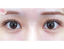 今月のベスト症例写真