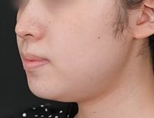 今月のベスト症例写真