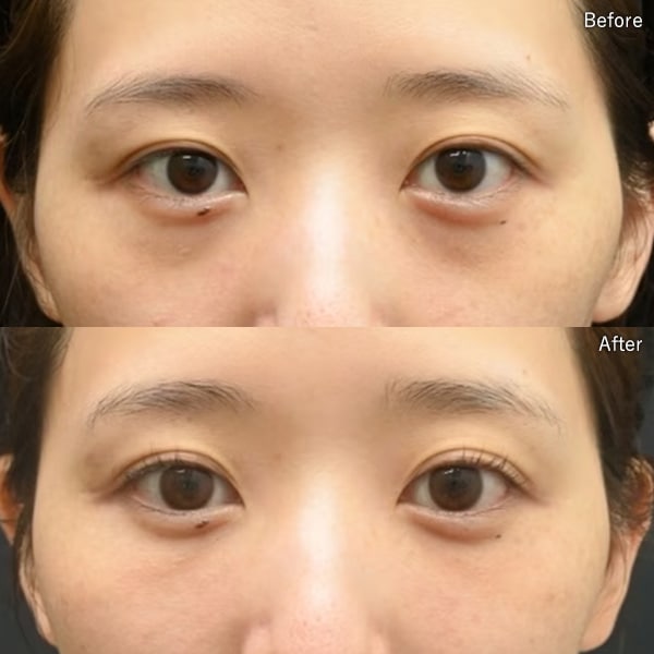 上田 将士医師 症例写真