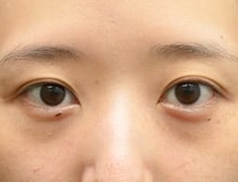 今月のベスト症例写真