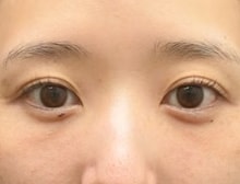 今月のベスト症例写真