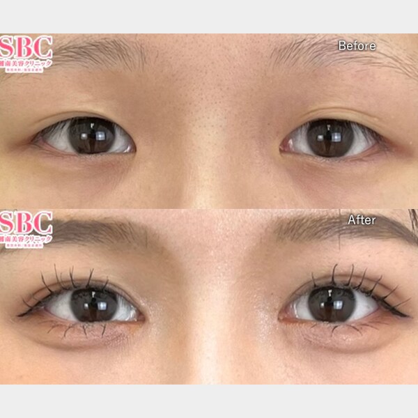 足立 紫音医師 症例写真