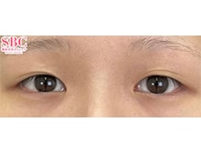 今月のベスト症例写真