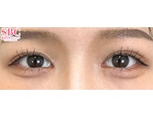 今月のベスト症例写真