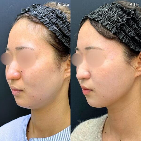 冨山 尭弘医師 症例写真