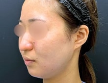 今月のベスト症例写真