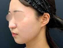 今月のベスト症例写真