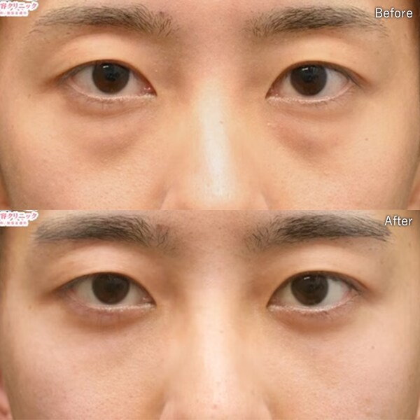 上田 将士医師 症例写真