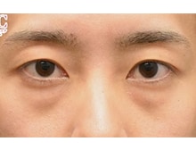 今月のベスト症例写真