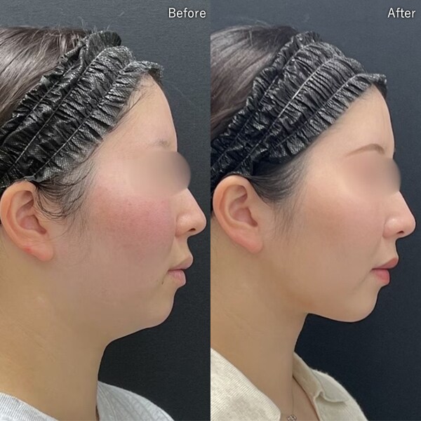 加藤 重磨医師 症例写真