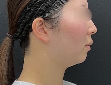 今月のベスト症例写真