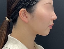 今月のベスト症例写真