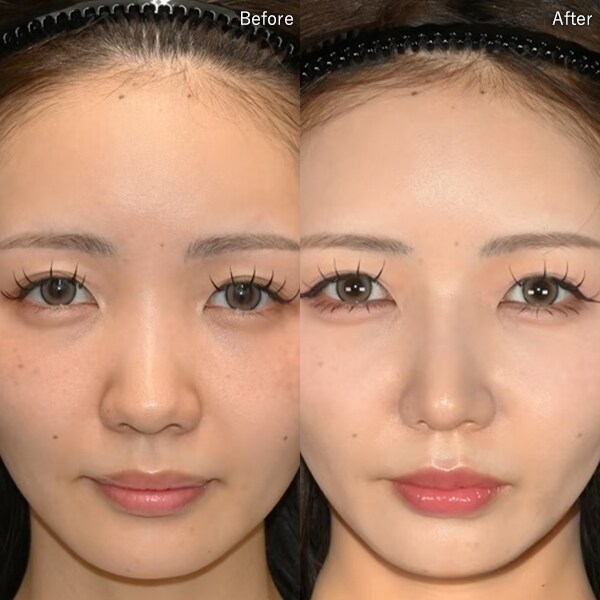 中野 達生医師 症例写真