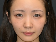 今月のベスト症例写真