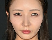 今月のベスト症例写真