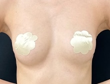 今月のベスト症例写真