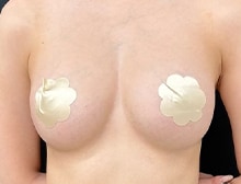 今月のベスト症例写真