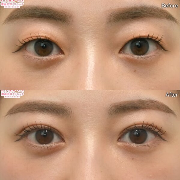 梶山 典彦医師 症例写真