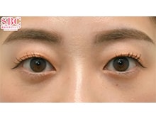 今月のベスト症例写真