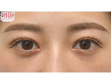 今月のベスト症例写真