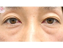 今月のベスト症例写真