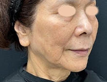 今月のベスト症例写真