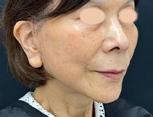 今月のベスト症例写真