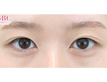 今月のベスト症例写真