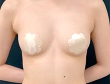 今月のベスト症例写真