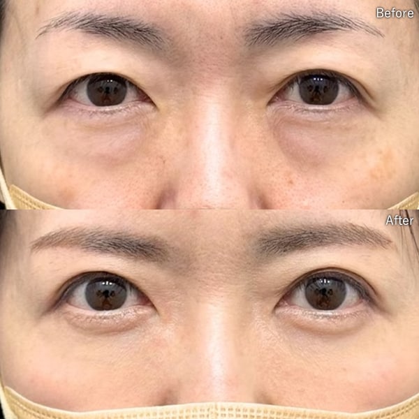 松阪 佑介医師 症例写真