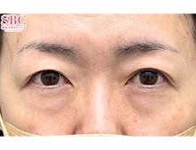 今月のベスト症例写真
