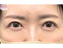 今月のベスト症例写真