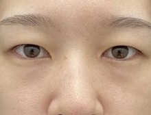 今月のベスト症例写真