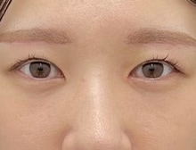 今月のベスト症例写真