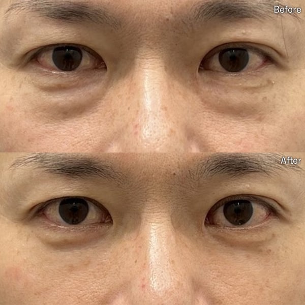 森澤 雄己医師 症例写真
