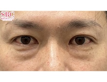 今月のベスト症例写真