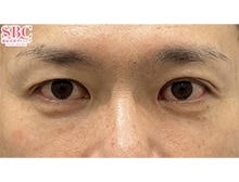 今月のベスト症例写真