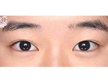 今月のベスト症例写真