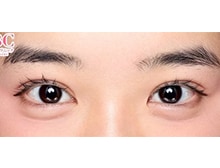 今月のベスト症例写真