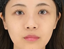 今月のベスト症例写真