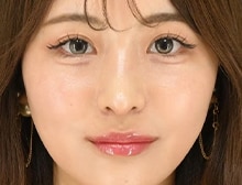 今月のベスト症例写真