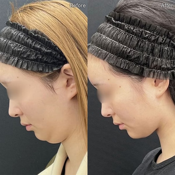 加藤重磨医師 症例写真