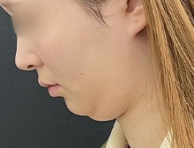 今月のベスト症例写真