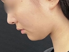 今月のベスト症例写真