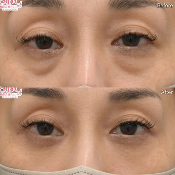 吉田祥啓医師 症例写真