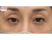 今月のベスト症例写真
